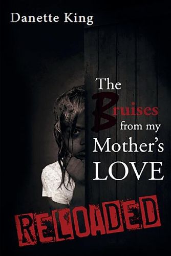 Cover image for The Bruises from my Mother's Love