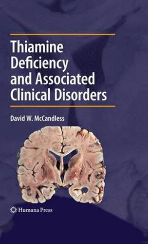 Thiamine Deficiency and Associated Clinical Disorders