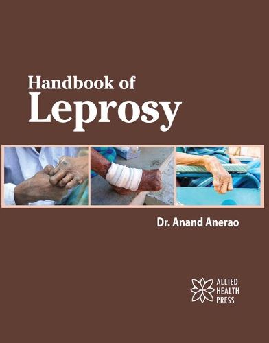 Cover image for Handbook of Leprosy