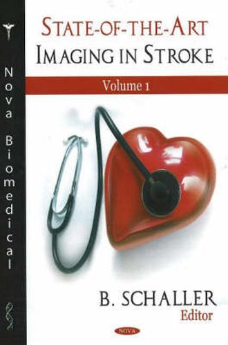 Cover image for State-of-the-Art Imaging in Stroke, Volume 1