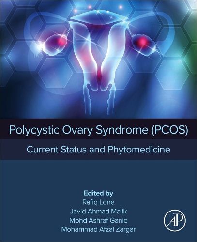 Cover image for Polycystic Ovary Syndrome (PCOS)