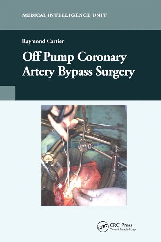 Cover image for Off-Pump Coronary Artery Bypass Surgery