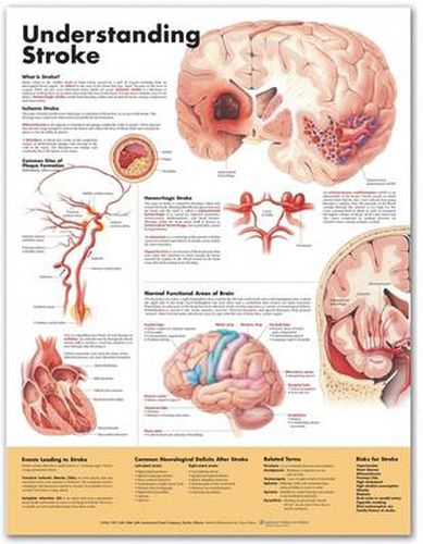 Cover image for Understanding Stroke Anatomical Chart