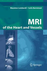 Cover image for MRI of the Heart and Vessels