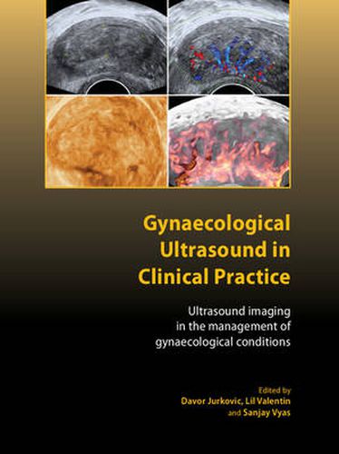 Cover image for Gynaecological Ultrasound in Clinical Practice: Ultrasound Imaging in the Management of Gynaecological Conditions