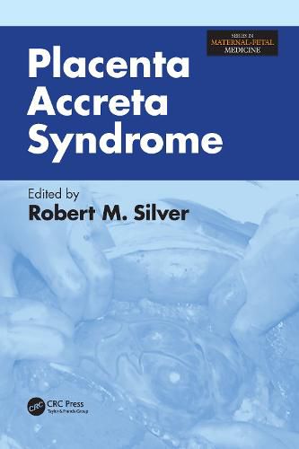 Cover image for Placenta Accreta Syndrome