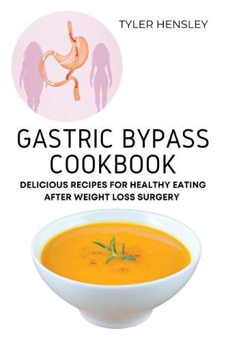 Cover image for Gastric Bypass Cookbook