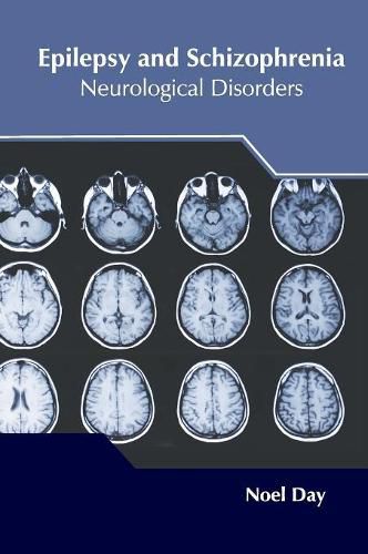 Cover image for Epilepsy and Schizophrenia: Neurological Disorders