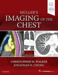 Cover image for Muller's Imaging of the Chest: Expert Radiology Series