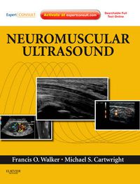 Cover image for Neuromuscular Ultrasound: Expert Consult - Online and Print