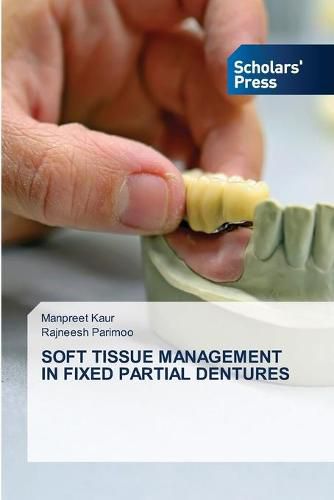 Cover image for Soft Tissue Management in Fixed Partial Dentures