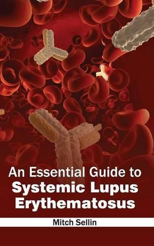 Cover image for Essential Guide to Systemic Lupus Erythematosus