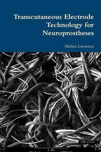 Cover image for Transcutaneous Electrode Technology for Neuroprostheses