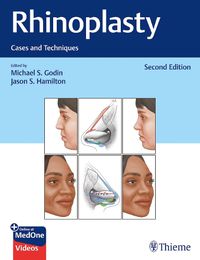 Cover image for Rhinoplasty