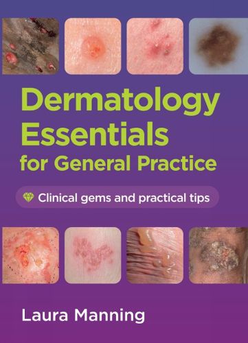 Cover image for Dermatology Essentials for General Practice