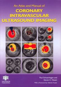 Cover image for An Atlas and Manual of Coronary Intravascular Ultrasound Imaging