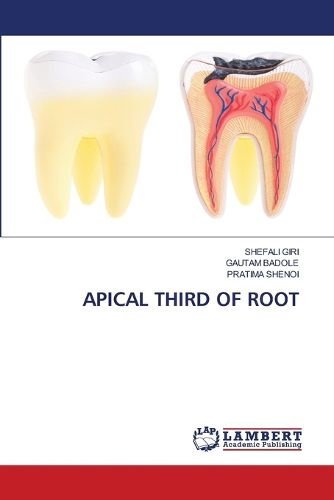 Cover image for Apical Third of Root