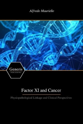 Cover image for Factor XI and Cancer