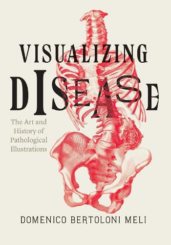 Visualizing Disease: The Art and History of Pathological Illustrations