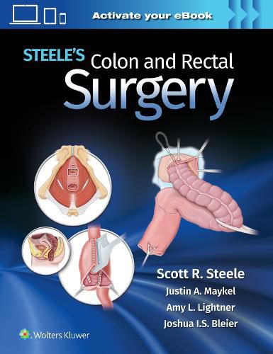 Cover image for Steele's Colon and Rectal Surgery