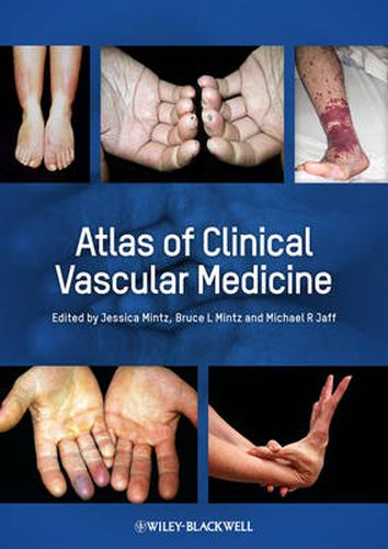 Cover image for Atlas of Clinical Vascular Medicine