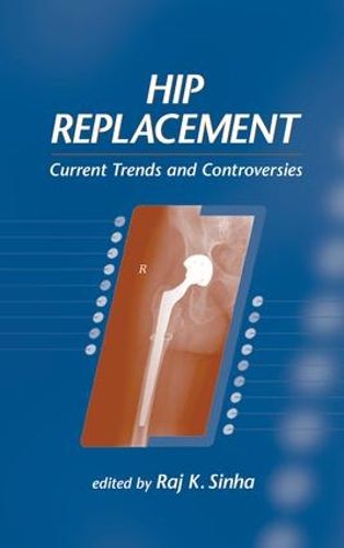 Cover image for Hip Replacement: Current Trends and Controversies