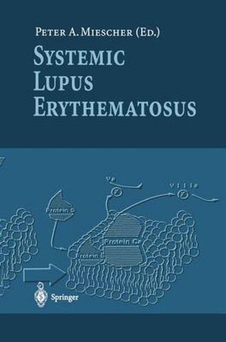 Cover image for Systemic Lupus Erythematosus