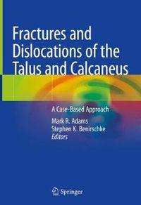 Cover image for Fractures and Dislocations of the Talus and Calcaneus: A Case-Based Approach