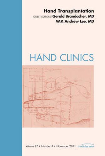 Cover image for Hand Transplantation, An Issue of Hand Clinics