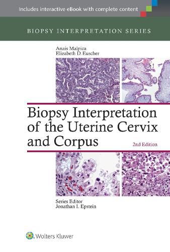 Cover image for Biopsy Interpretation of the Uterine Cervix and Corpus