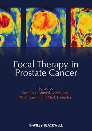 Cover image for Focal Therapy in Prostate Cancer