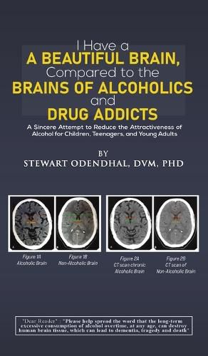 Cover image for I Have a Beautiful Brain, Compared to the Brains of Alcoholics and Drug Addicts