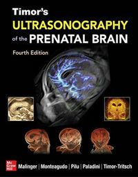 Cover image for Ultrasonography of the Prenatal Brain, Fourth Edition