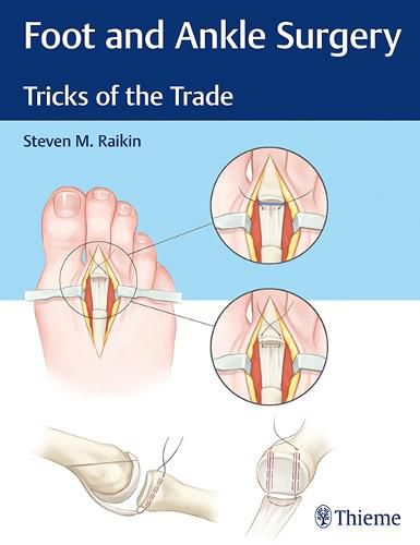 Cover image for Foot and Ankle Surgery: Tricks of the Trade