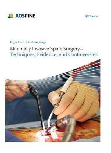 Minimally Invasive Spine Surgery - Techniques, Evidence, and Controversies