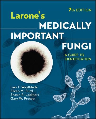 Cover image for Larone's Medically Important Fungi