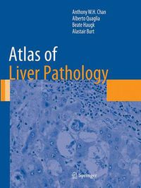 Cover image for Atlas of Liver Pathology