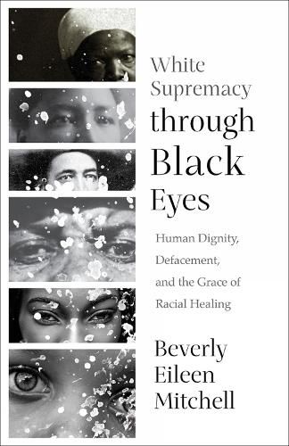 Cover image for White Supremacy through Black Eyes