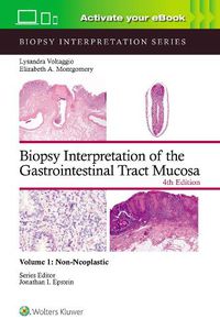 Cover image for Biopsy Interpretation of the Gastrointestinal Tract Mucosa Volume 1