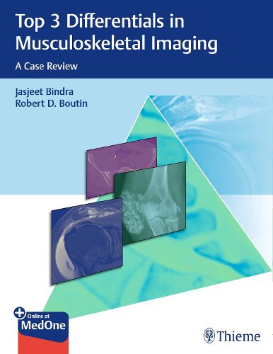 Cover image for Top 3 Differentials in Musculoskeletal Imaging: A Case Review