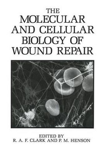 Cover image for The Molecular and Cellular Biology of Wound Repair