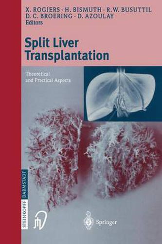 Cover image for Split liver transplantation: Theoretical and practical aspects