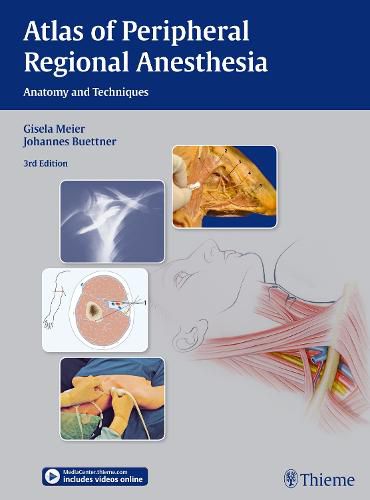 Cover image for Atlas of Peripheral Regional Anesthesia: Anatomy and Techniques