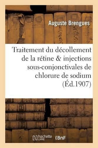 Du Traitement Du Decollement de la Retine & Injections Sous-Conjonctivales de Chlorure de Sodium