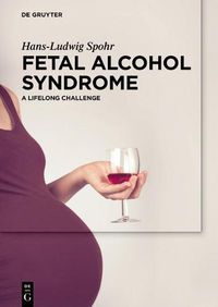 Cover image for Fetal Alcohol Syndrome: A lifelong Challenge