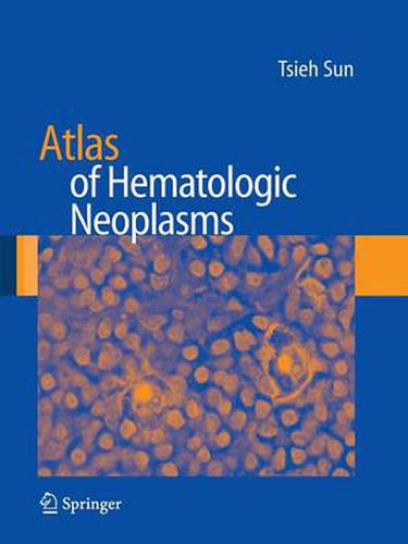 Cover image for Atlas of Hematologic Neoplasms