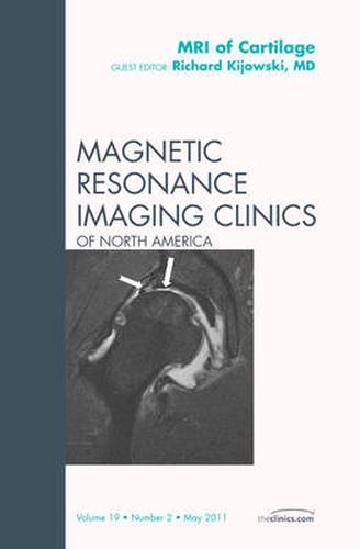 Cover image for MRI of Cartilage, An Issue of Magnetic Resonance Imaging Clinics