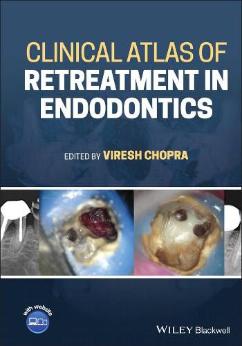 Cover image for Clinical Atlas of Retreatment in Endodontics