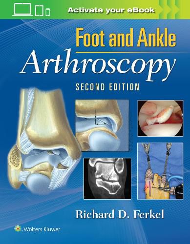 Cover image for Foot & Ankle Arthroscopy