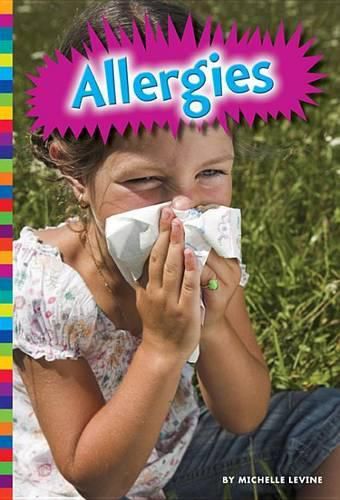 Cover image for Allergies